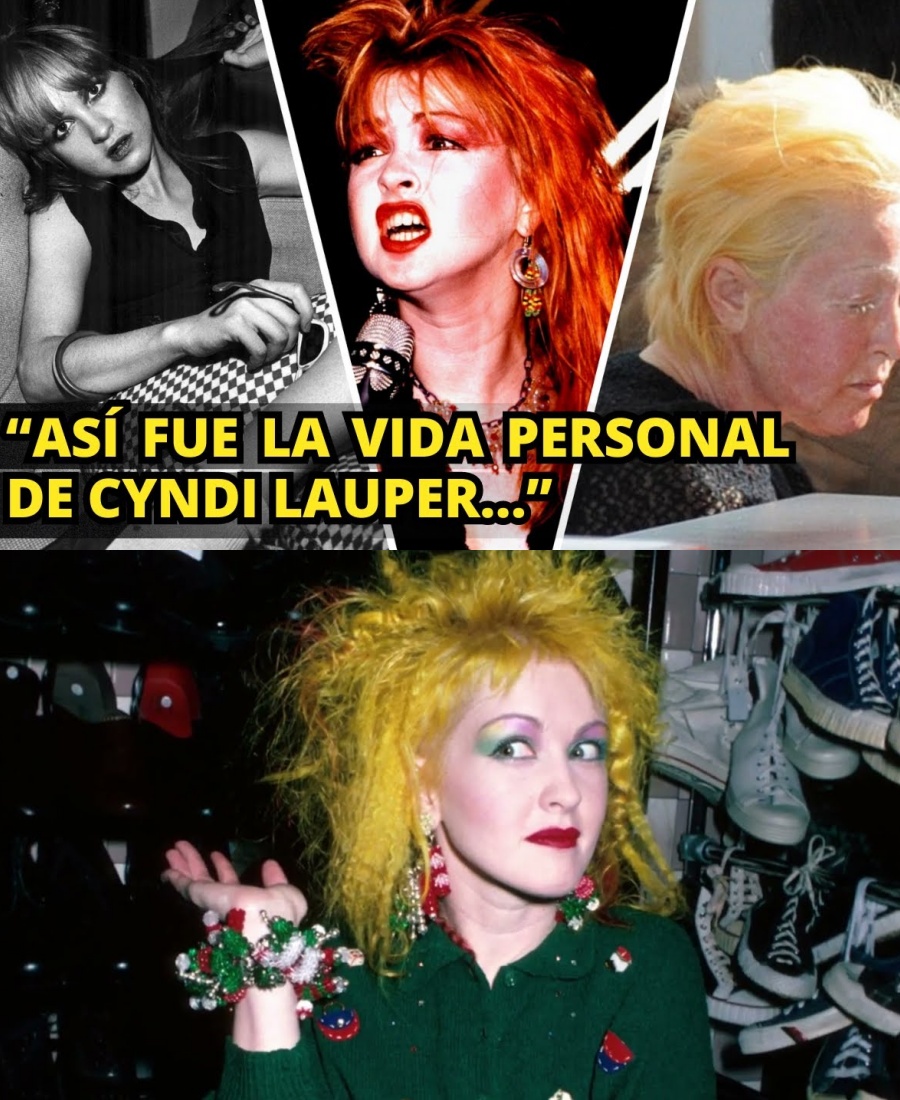 ยฟSabes lo que le pasรณ a Cyndi Lauper? Cรณmo superรณ la terrible violencia, la depresiรณn y la psoriasis